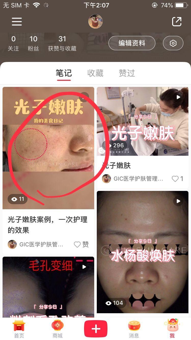 待分类 小红书简单任务，关注点赞 步骤图1