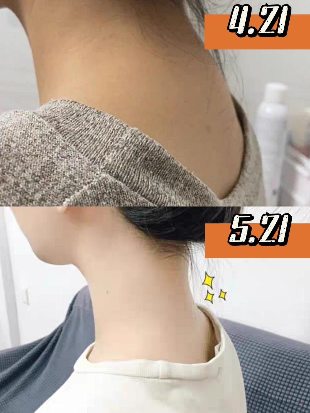 小红书 小红书发布笔记 步骤图1