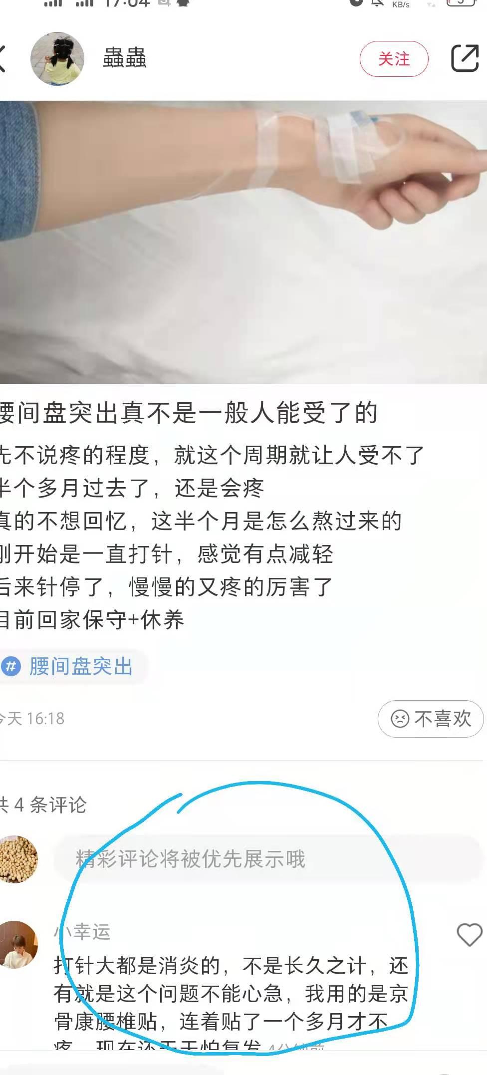 小红书 小红书点赞的任务 步骤图1