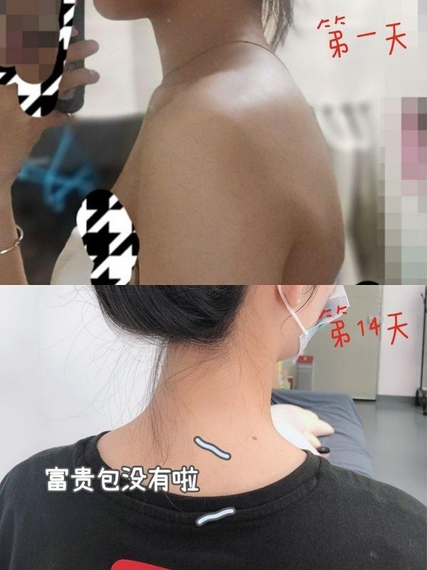 小红书 小红书发布笔记 步骤图1