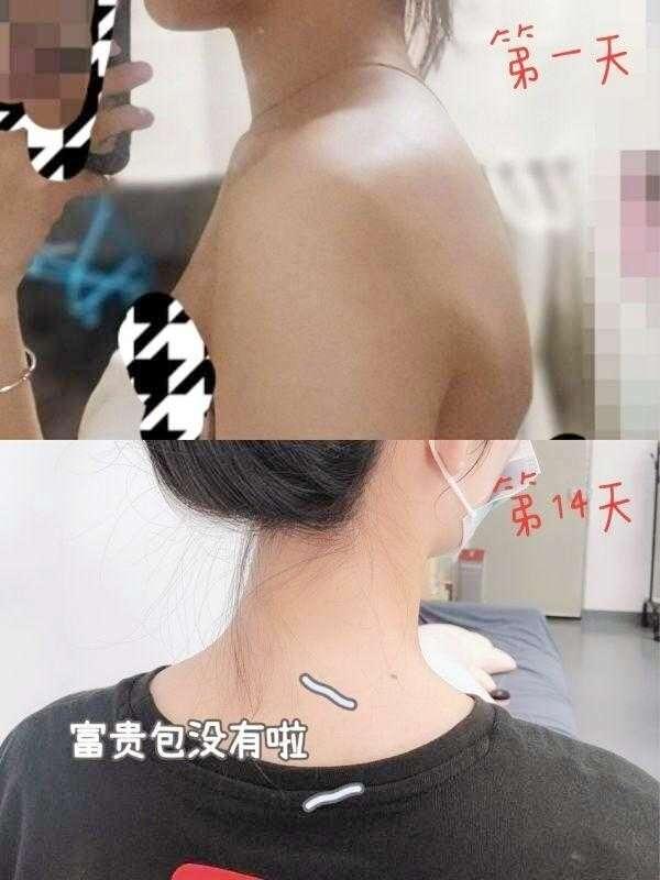 评论 小红书 小红书发布笔记 步骤图1