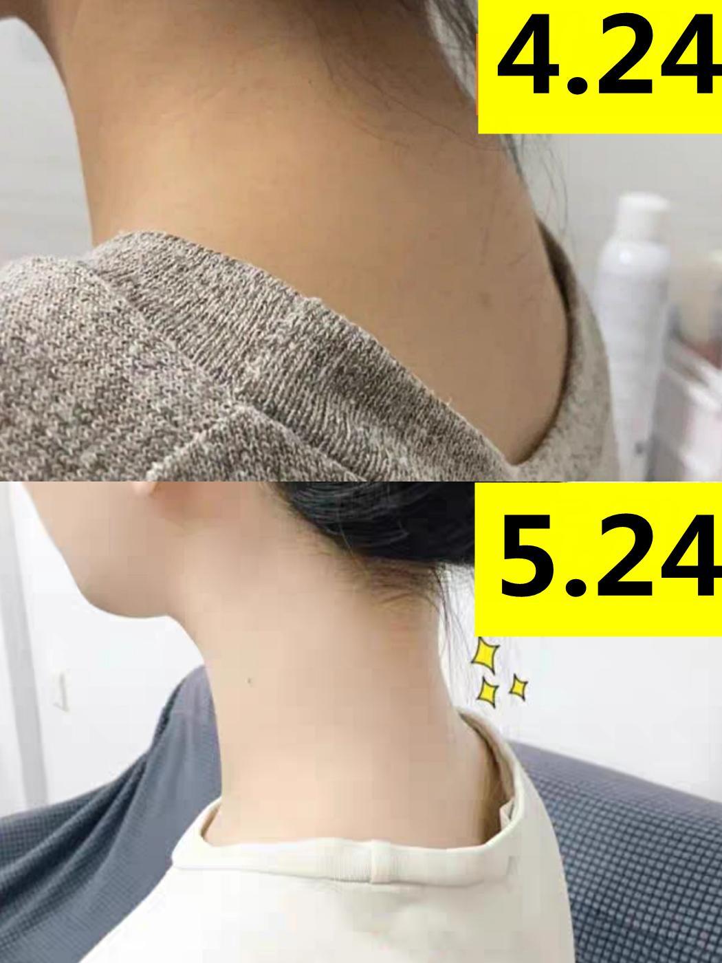 小红书 小红书发布笔记 步骤图1