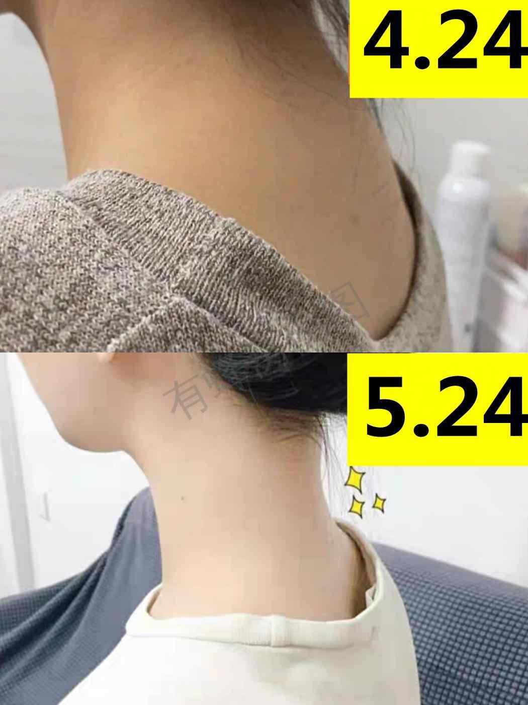 小红书 小红书发布笔记 步骤图1