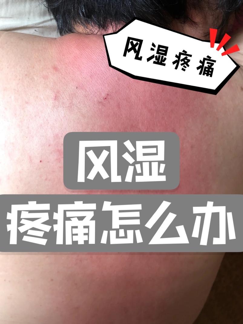 评论 小红书 小红书发布笔记 步骤图1