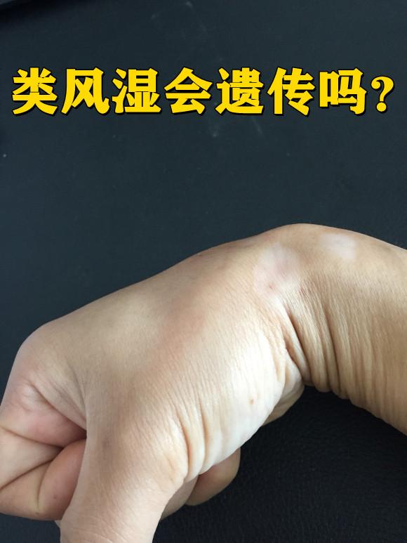 小红书 小红书发布笔记 步骤图1