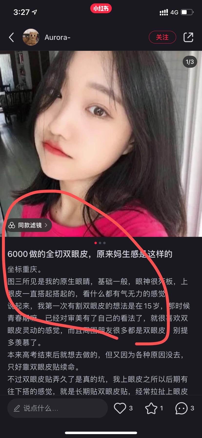 点赞/收藏 渣渣的任务 步骤图2