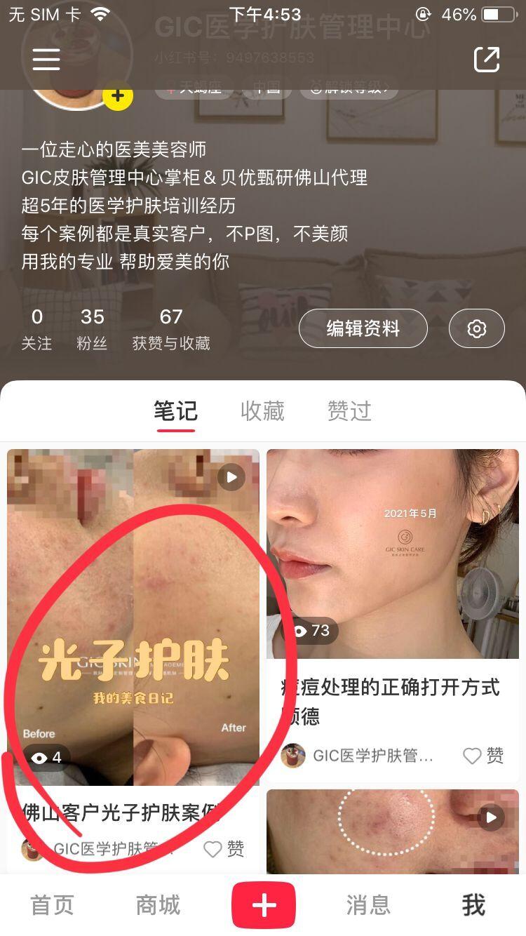 关注 点赞/收藏 小红书 邹其宝的任务小红书关注点赞 步骤图1
