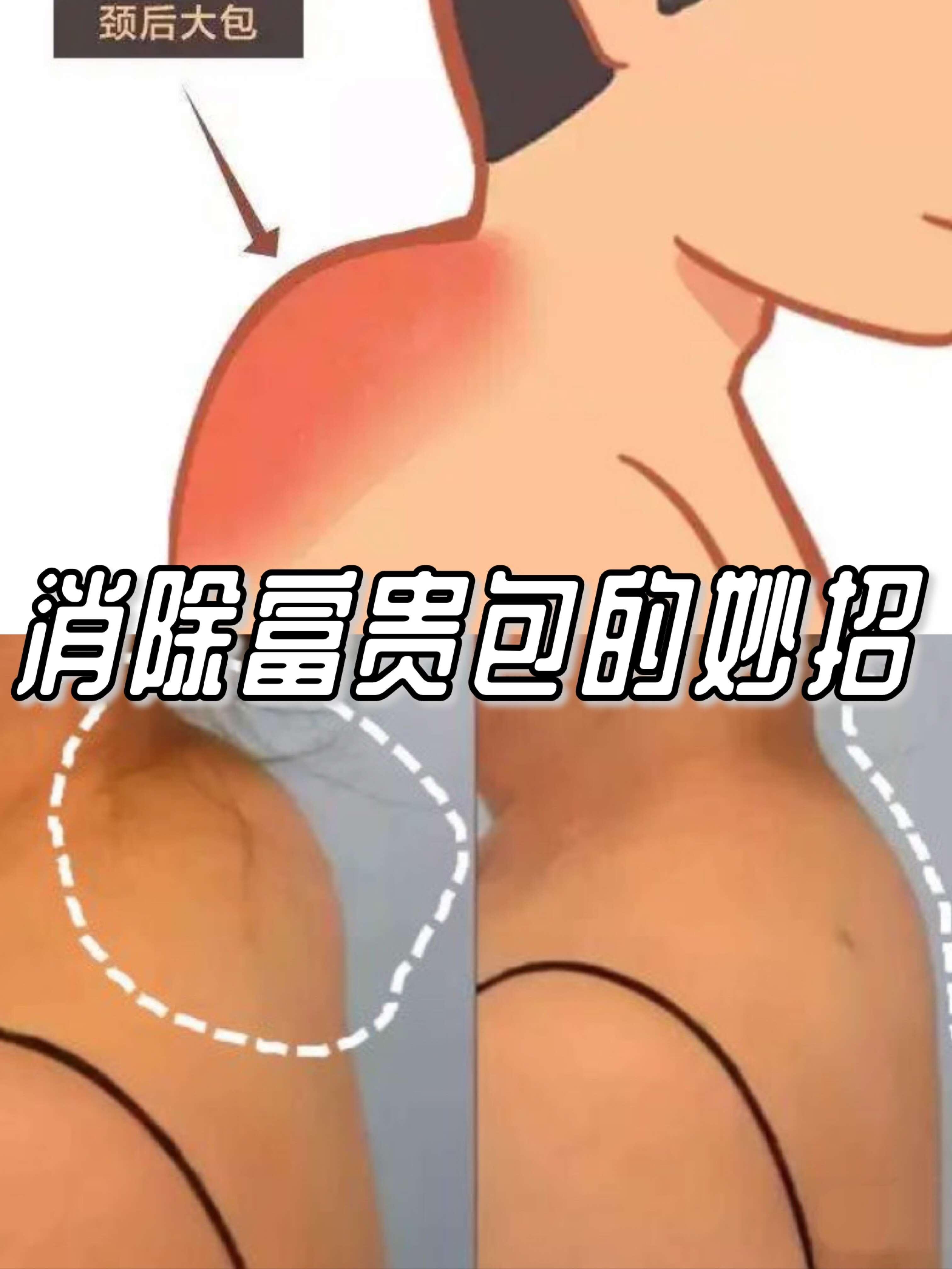 小红书 小红书发布笔记 步骤图1