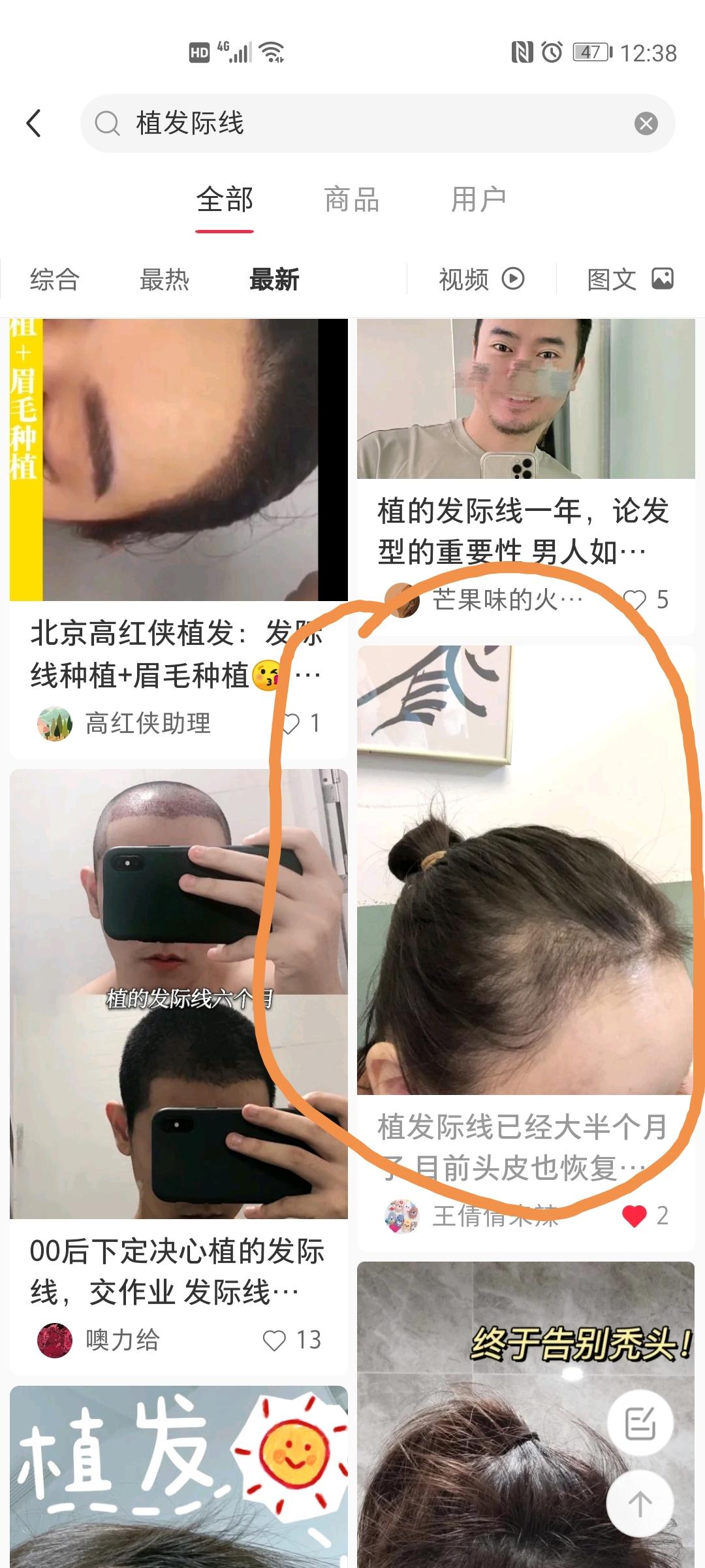 评论 小红书 小红书，搜索，评论 步骤图1