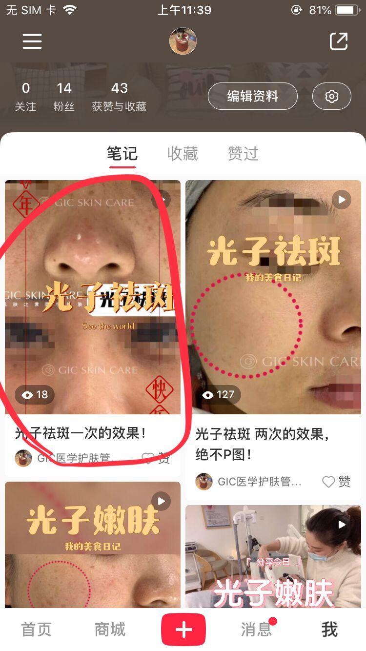 关注 点赞/收藏 小红书 小红书简单任务，关注点赞... 步骤图1