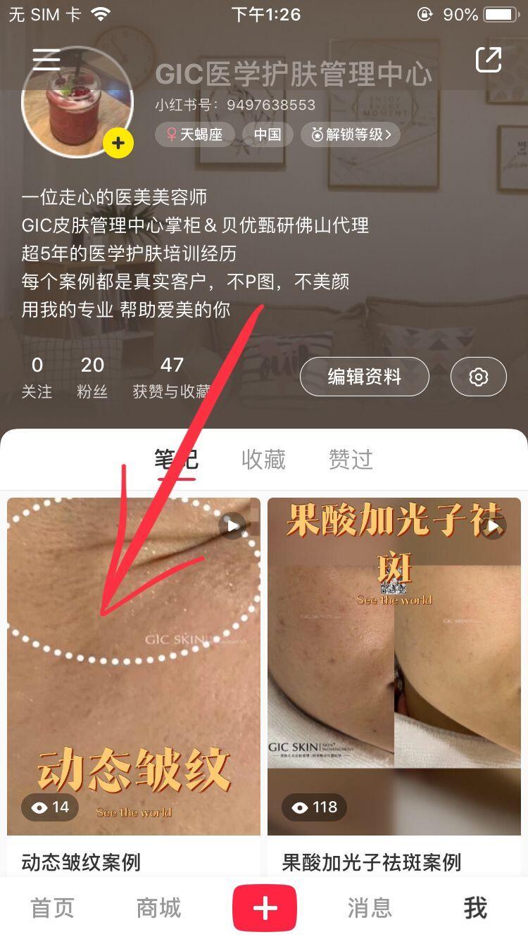 待分类 小红书简单任务，关注点赞. 步骤图1