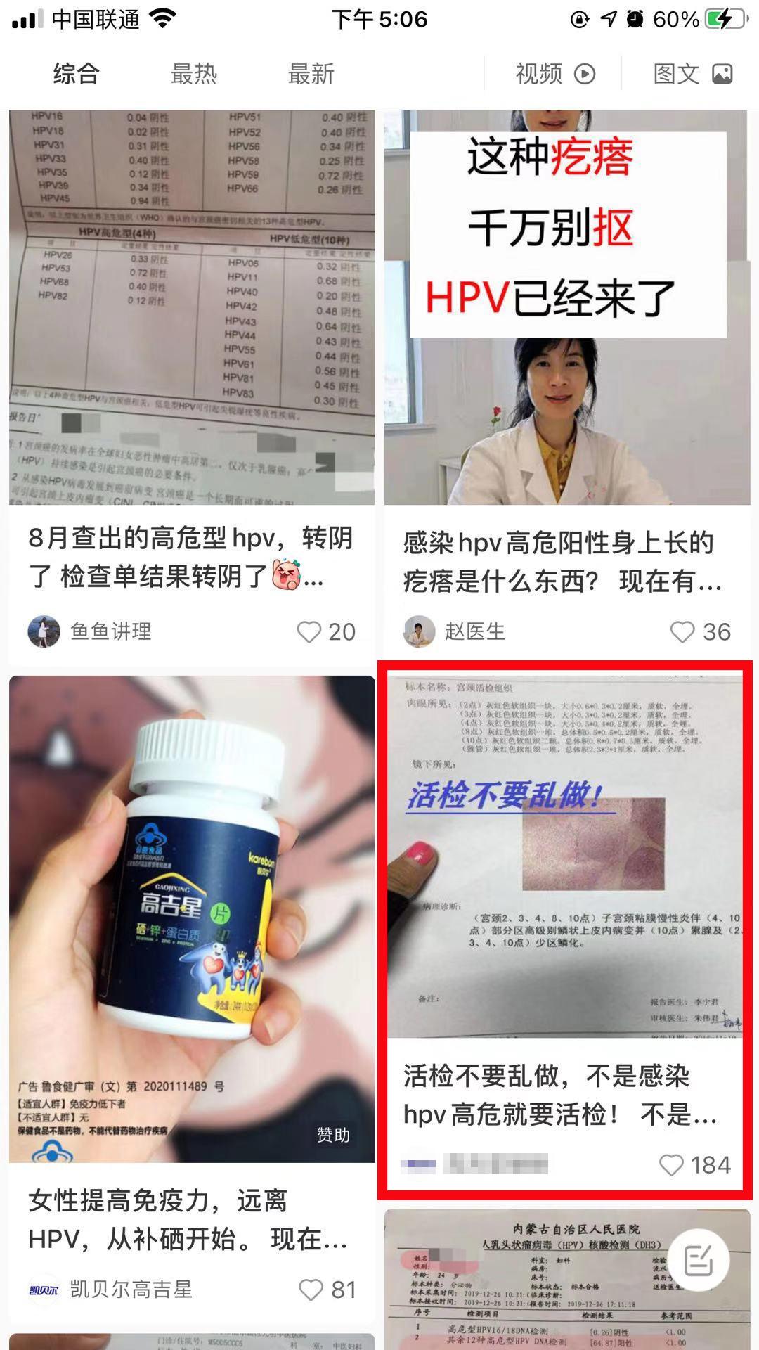 关注 搜索 点赞/收藏 小红书 手机用户185****2609的任务 步骤图1