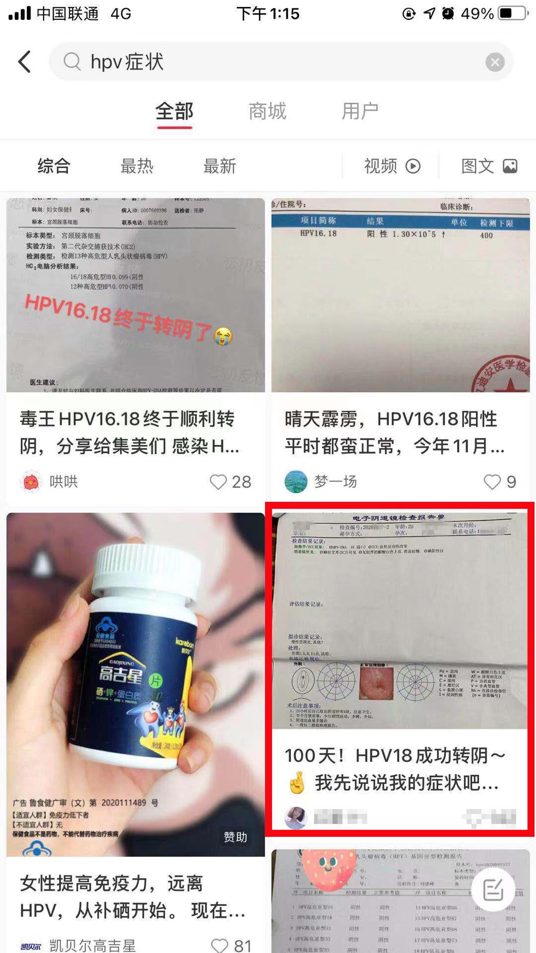 关注 搜索 点赞/收藏 小红书 手机用户185****2609的任务 步骤图1