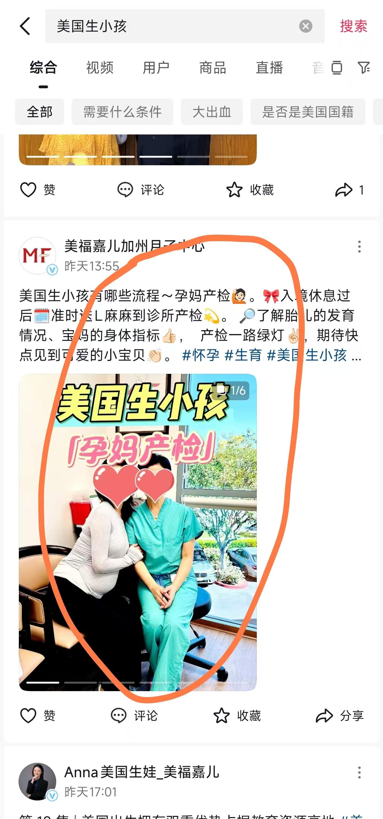 抖音 点赞 收藏 转发 评论 手机用户131****6735的推荐 步骤图1