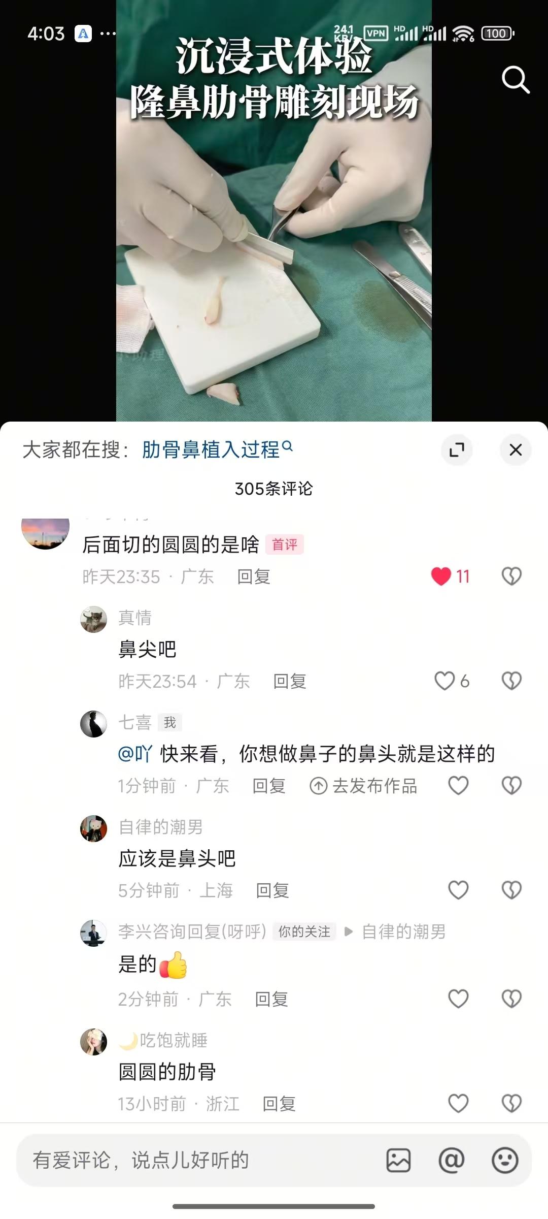 抖音 点赞 手机用户135****5275的推荐 步骤图1